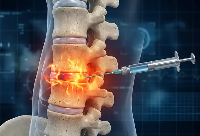 Medical professional administering spinal injection for back pain relief