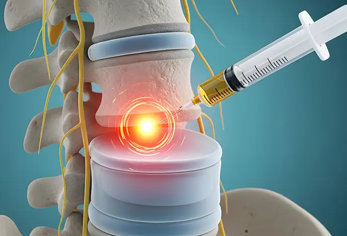 Spinal cord injection for chronic pain management