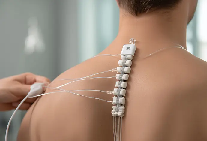Spinal cord stimulator