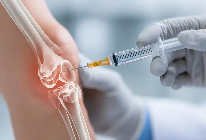 Clinician injecting knee joint illustrating non-surgical orthopedics treatment for knee osteoarthritis
