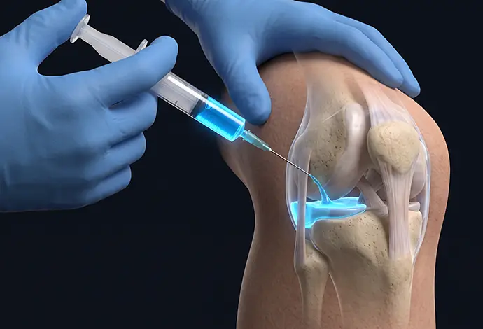 Medical professional administering an injection of fluid into a knee joint for treatment or pain relief