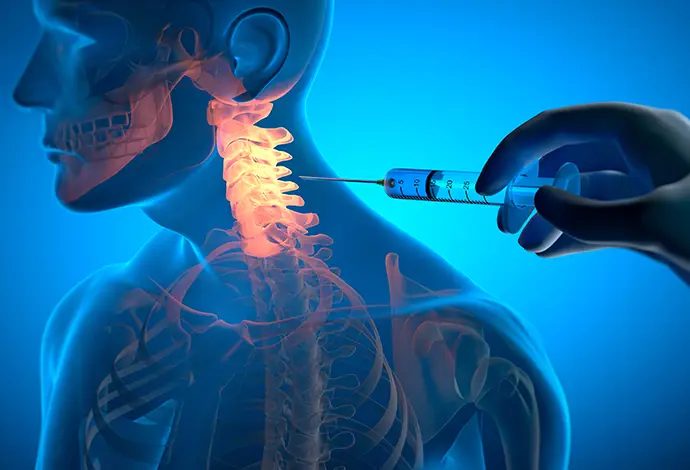 spinal drug injection for neck pain treatment