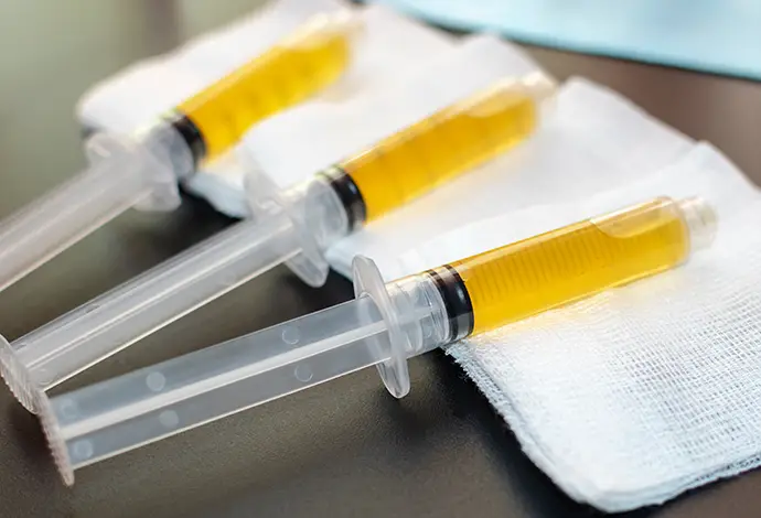 Syringes with Platelet-Rich plasma preparation for therapy
