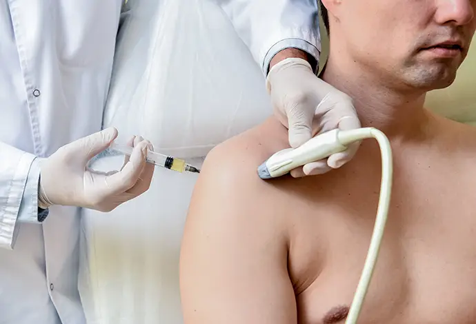 Ultrasound-guided platelet-rich plasma injection of the shoulder