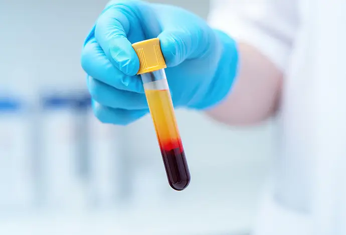 Gloved hand holding centrifuged blood tube, plasma separation for prp prf ppp cgf therapy